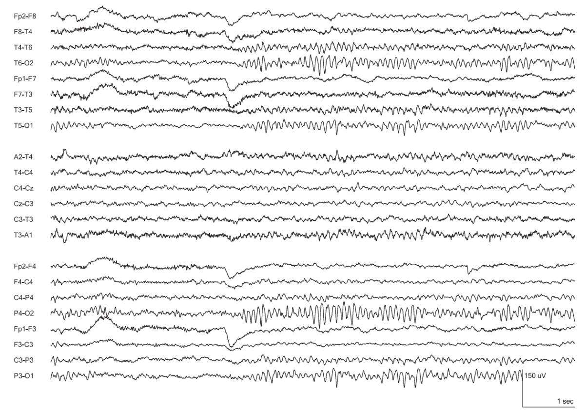 The EEG Game – a game-based educational tool