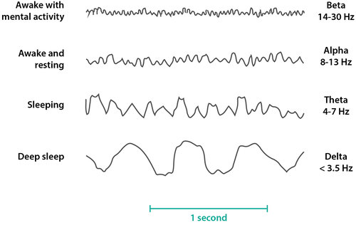 Basic EEG frequencies 